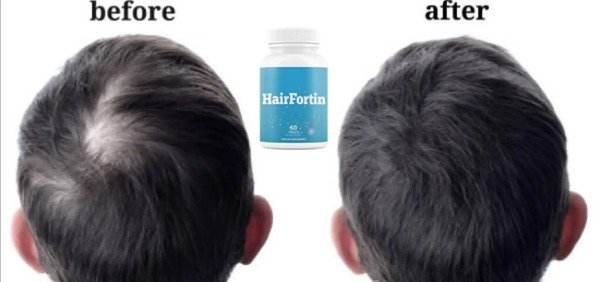 HairFortin natural hair supplement